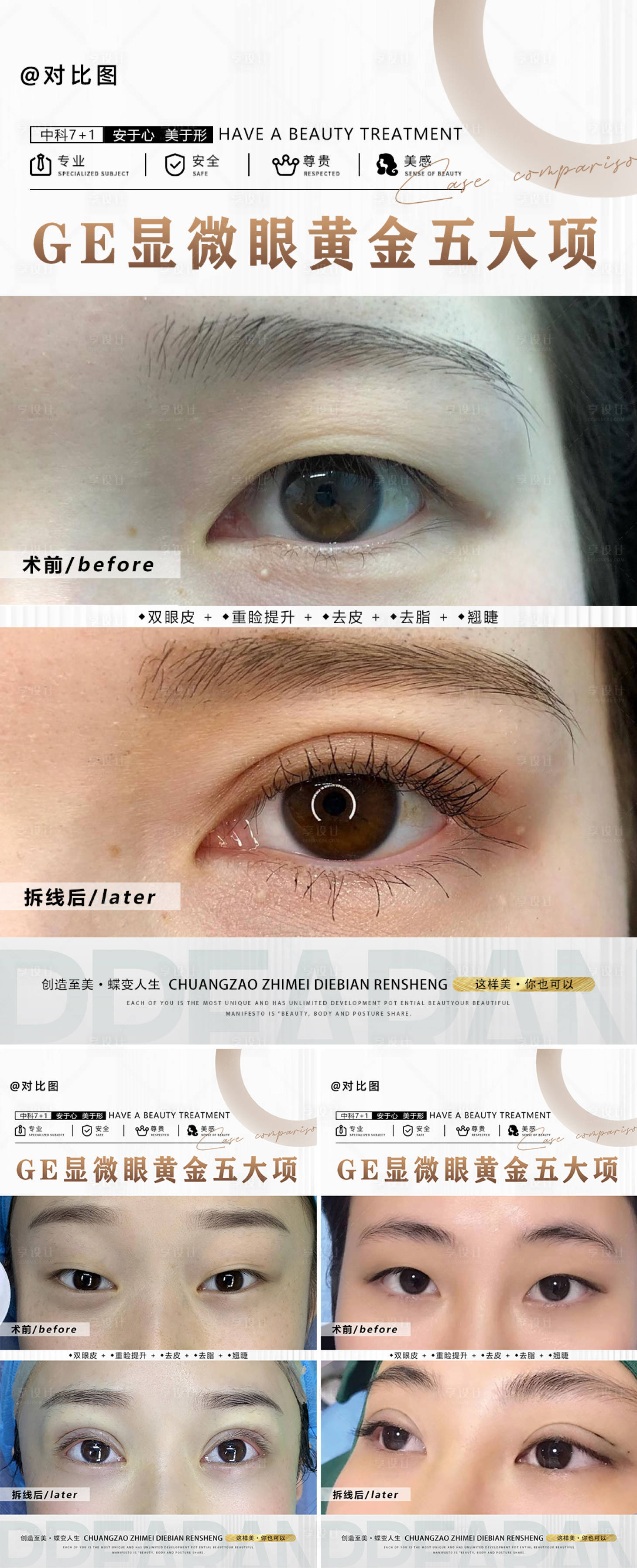 源文件下載【享設(shè)計(jì)】搜索編號：90490018206226286【醫(yī)美雙眼皮對比案列】
