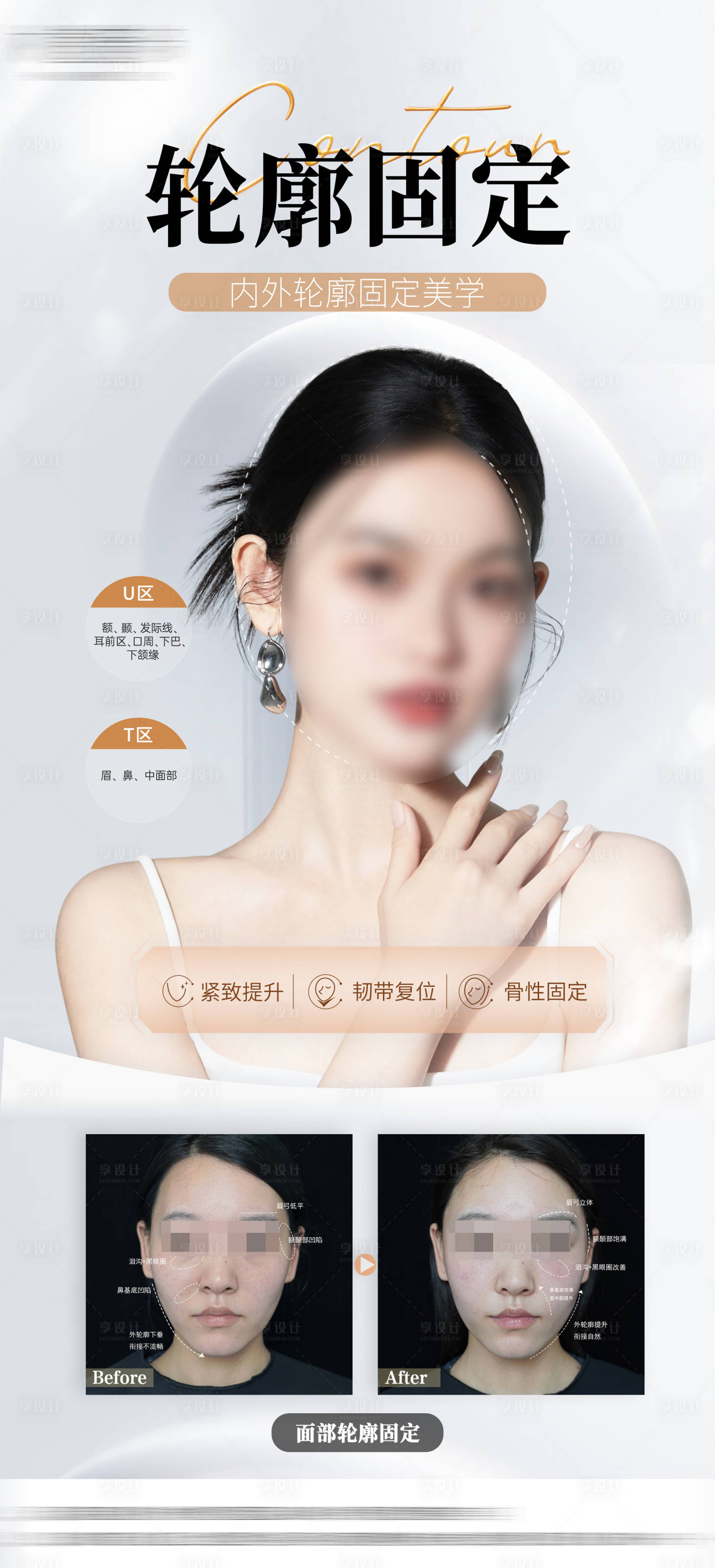 源文件下載【享設計】搜索編號：21230018026856776【醫美海報】