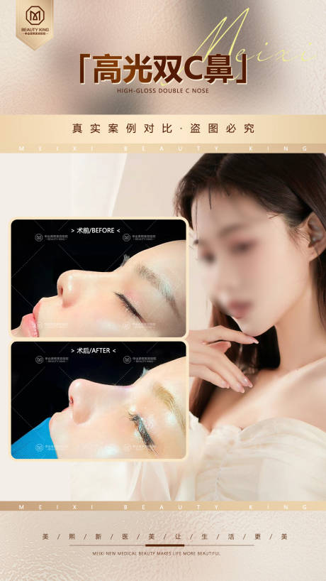 源文件下載【享設計】搜索編號：54730018283778567【醫美隆鼻案例海報】