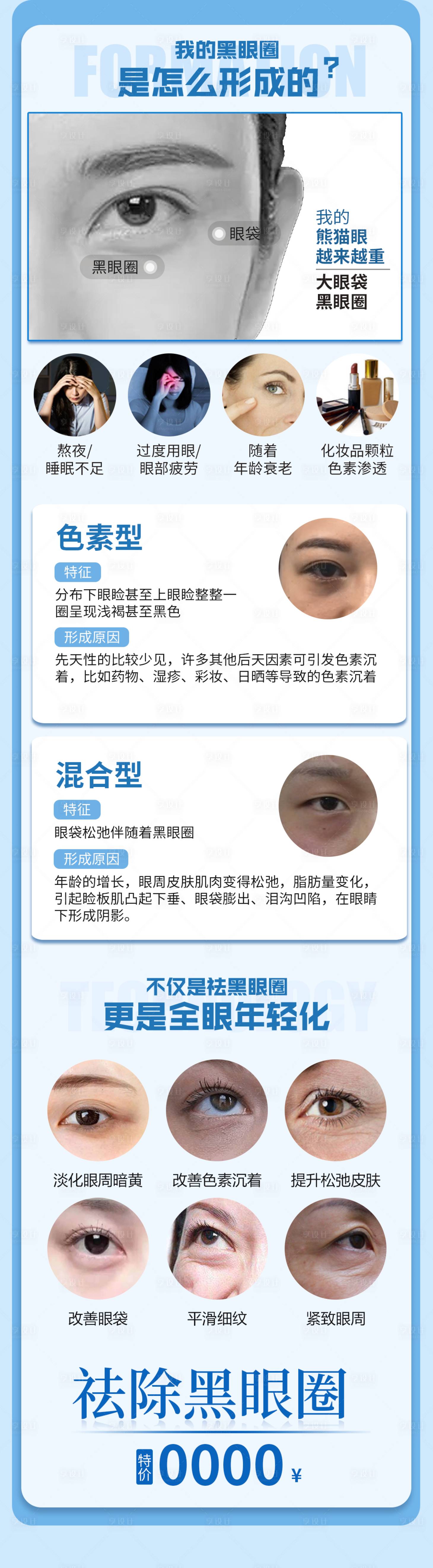 源文件下载【享设计】搜索编号：98640017892257111【黑眼圈科普长图】