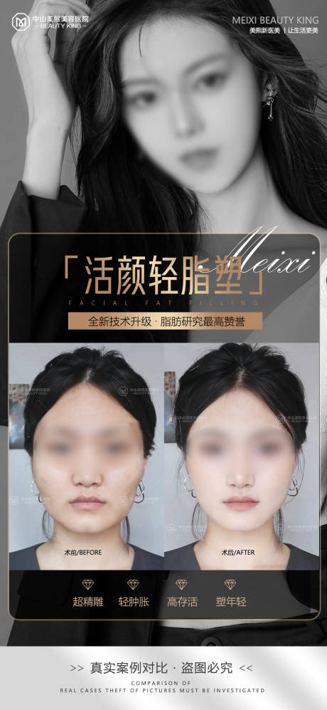 源文件下载【医美脸部填充案例海报】编号：20230705164819705