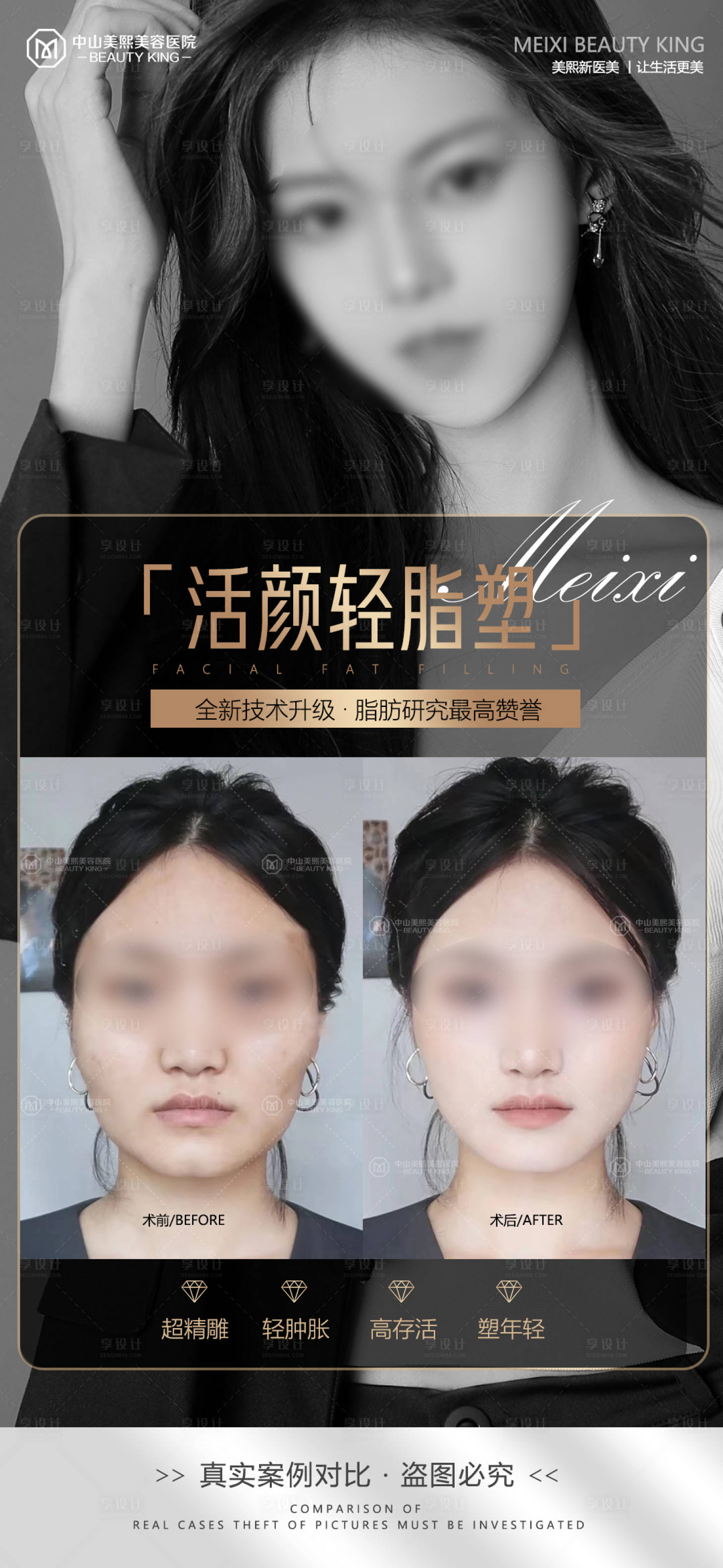 源文件下载【享设计】搜索编号：19540017834797070【医美脸部填充案例海报】
