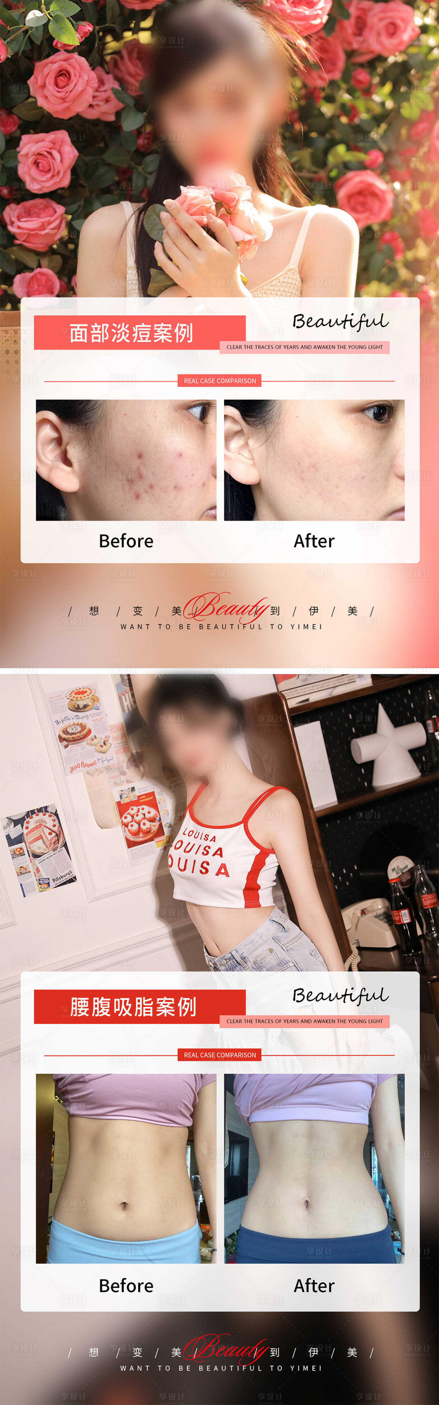 源文件下载【享设计】搜索编号：56850018307258549【医美案例对比简约海报】