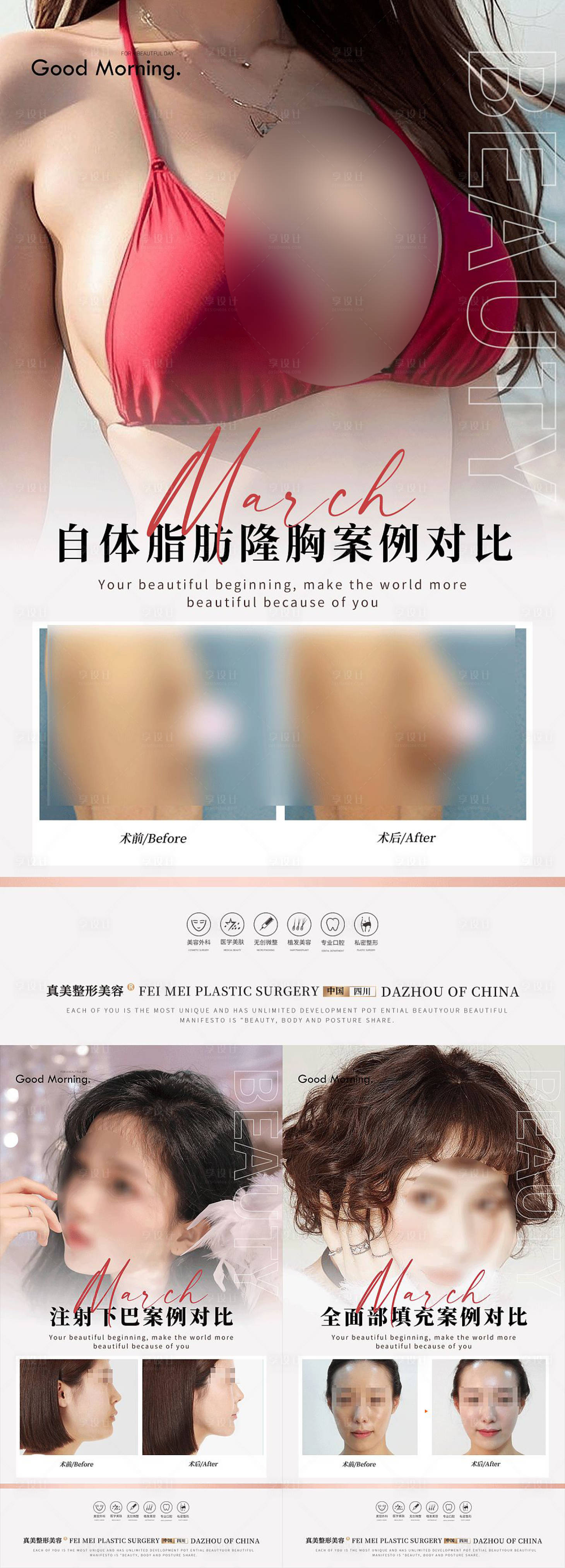 源文件下载【医美整形案例集】编号：17940017901247490