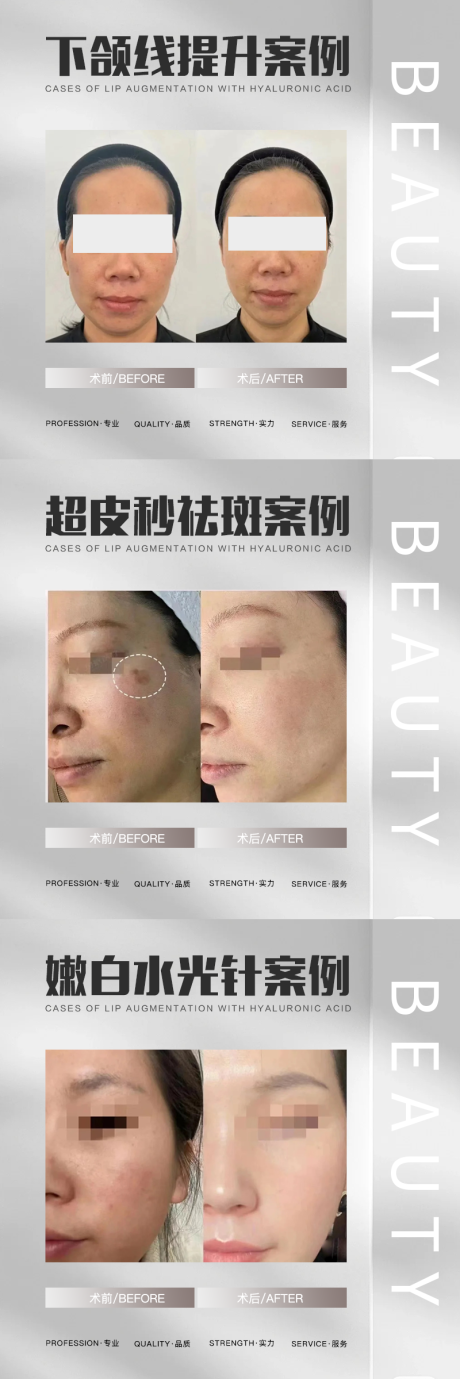 源文件下载【医美案例对比海报】编号：72980017749427608