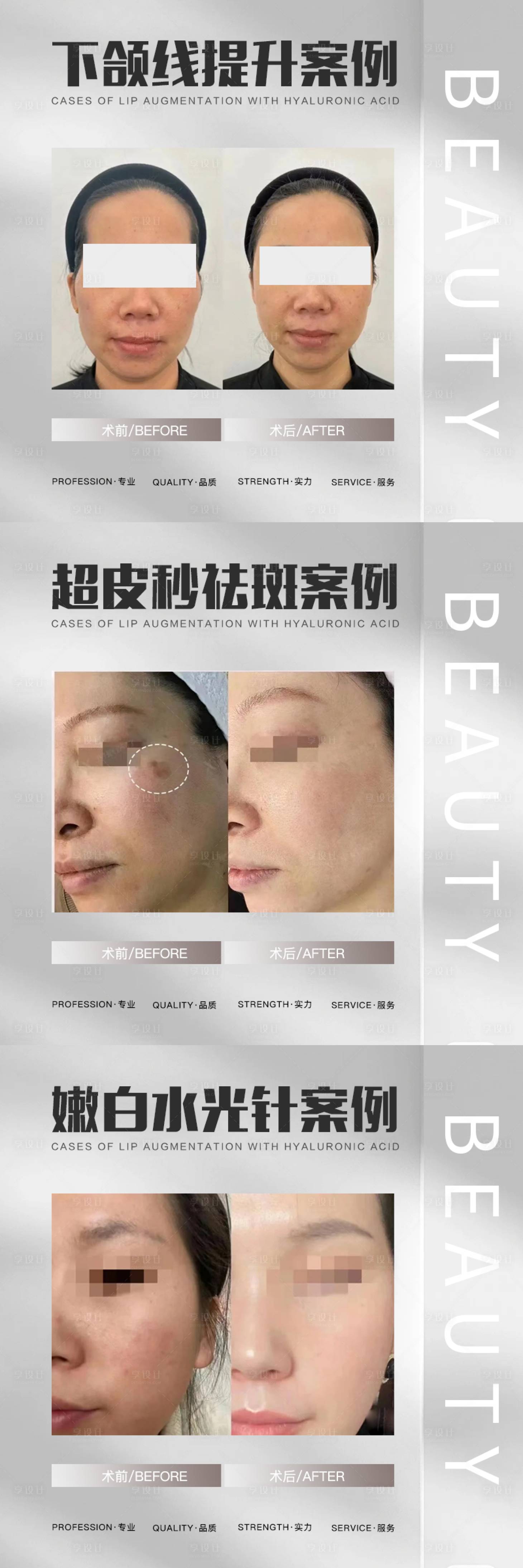 源文件下载【享设计】搜索编号：72980017749427608【医美案例对比海报】