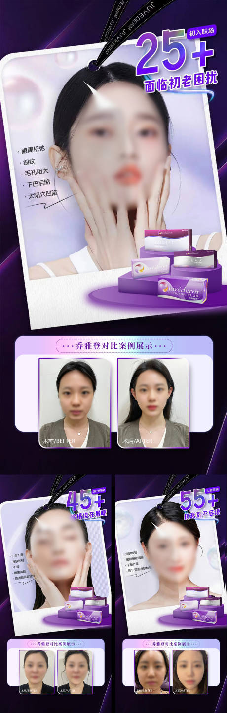 源文件下载【乔雅登案例海报】编号：47580018206924242