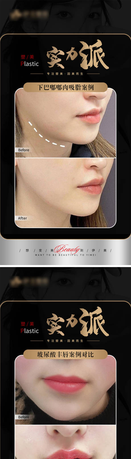 源文件下载【享设计】搜索编号：91780018333628068【医美案例对比系列海报】