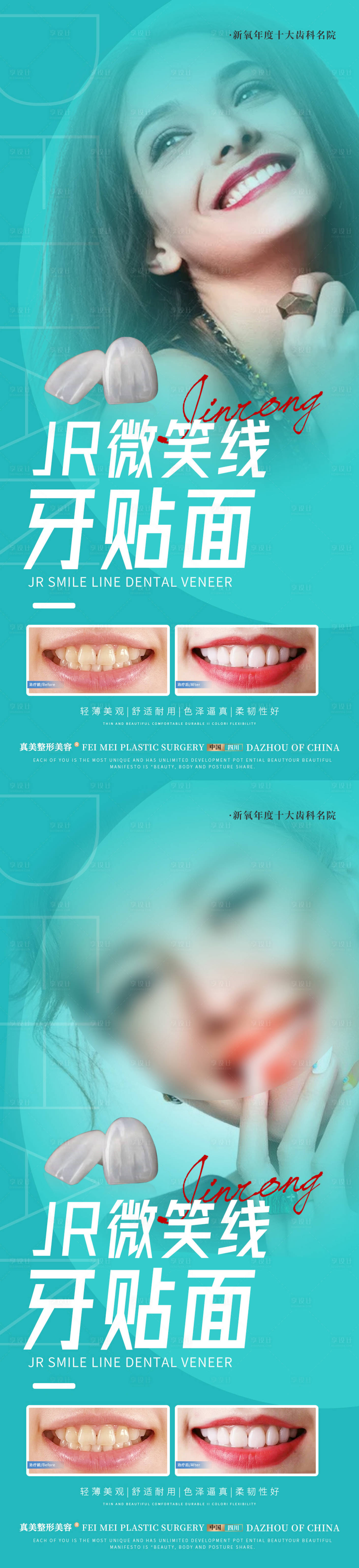 源文件下载【享设计】搜索编号：38370017741364155【医美牙贴面案例海报】
