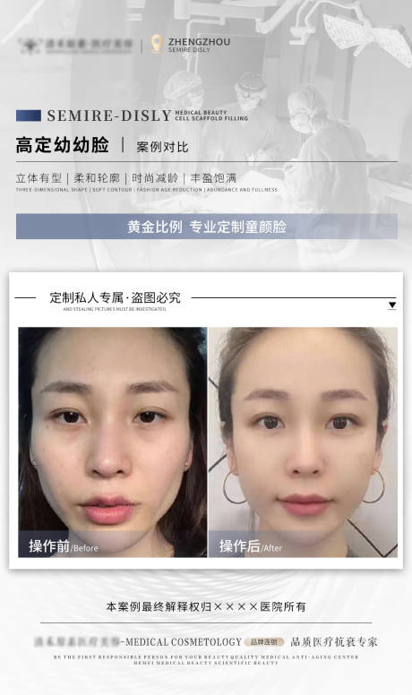 源文件下载【幼幼脸案例对比】编号：62640018280367397