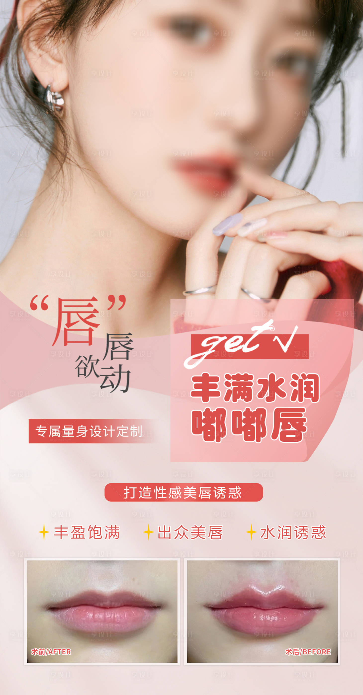 源文件下載【玻尿酸豐唇海報】編號：63950018383525093