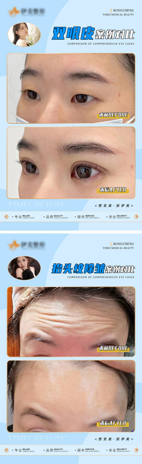 源文件下载【医美案例对比海报】编号：31440018310919014