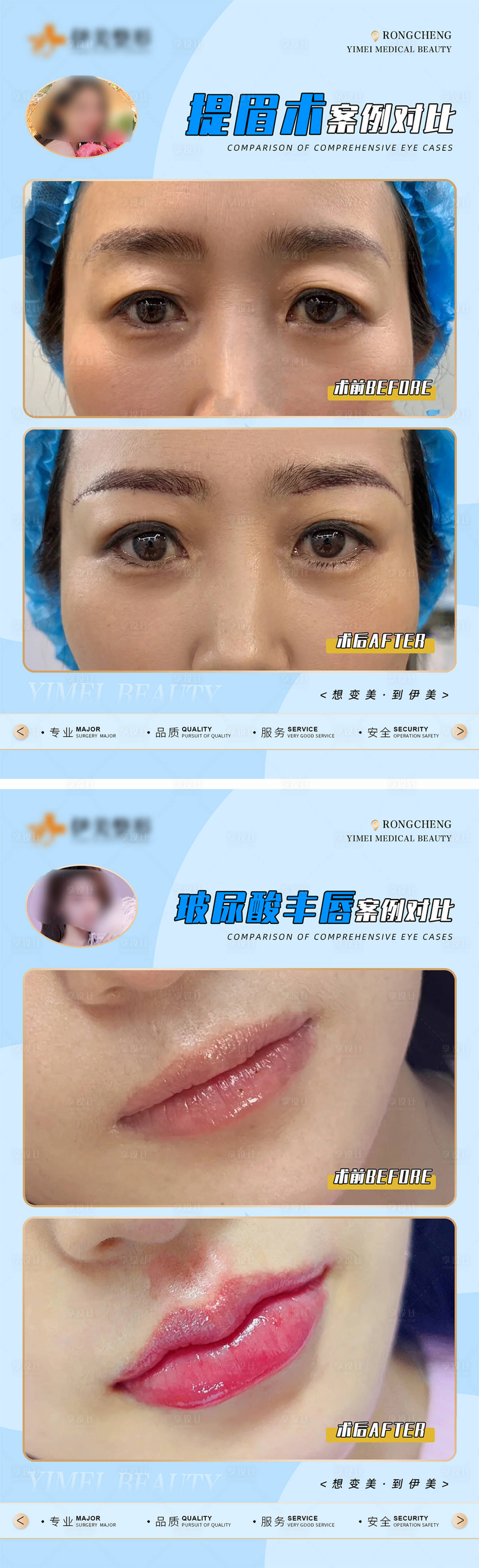 源文件下载【享设计】搜索编号：61420018272755033【医美案例对比模版海报】