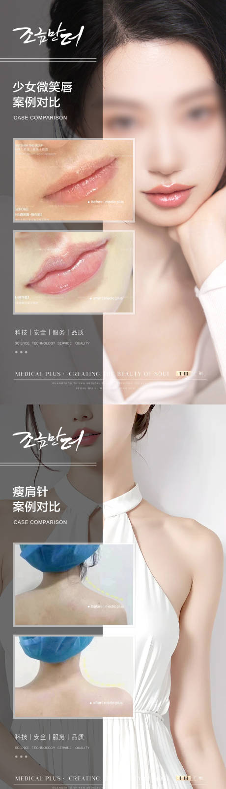 源文件下载【医美案例】编号：32180018688614498