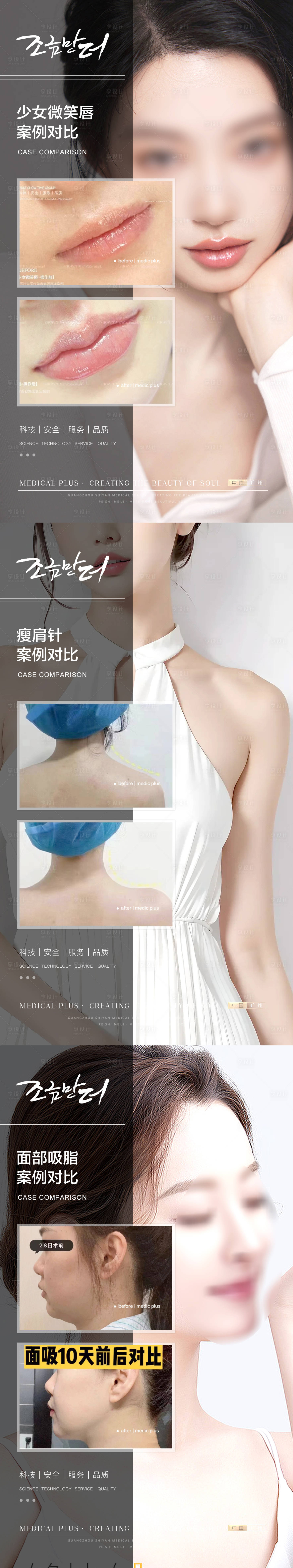源文件下载【享设计】搜索编号：32180018688614498【医美案例】