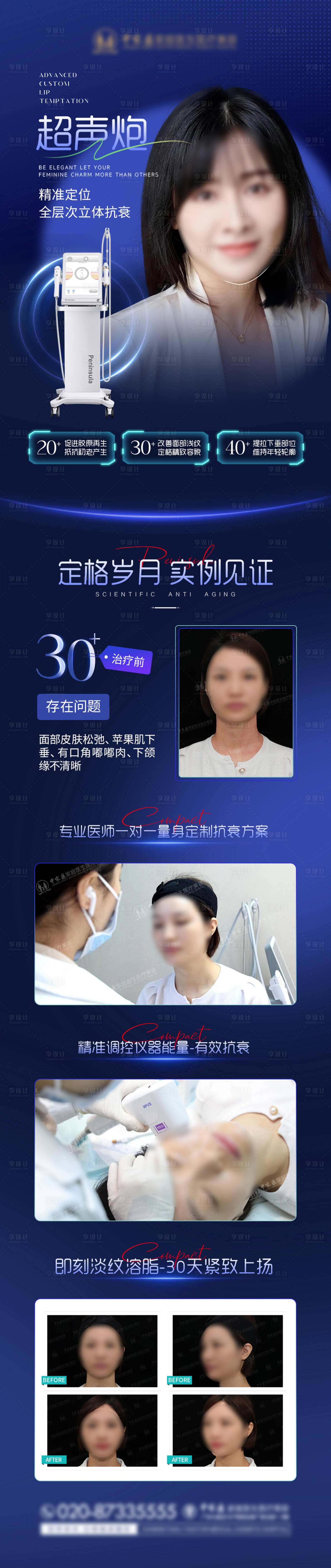 源文件下载【超声炮长图】编号：59580018427822219