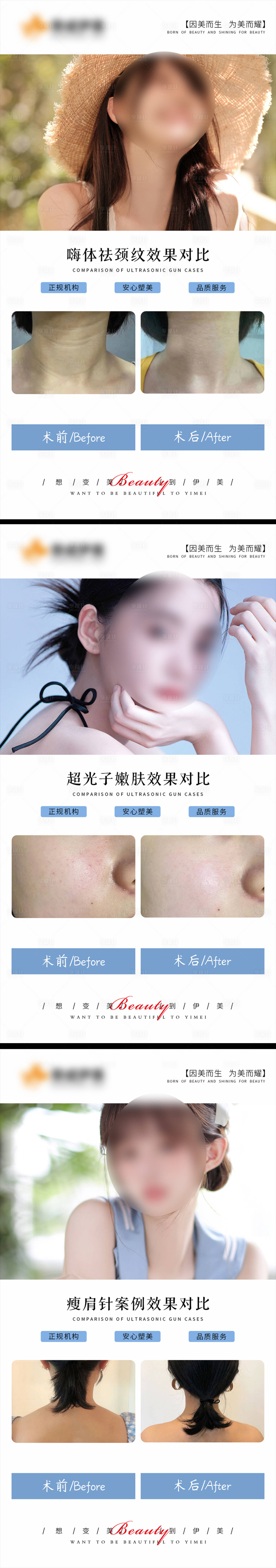 源文件下載【享設(shè)計(jì)】搜索編號(hào)：65410018983552917【醫(yī)美案例對比海報(bào)】