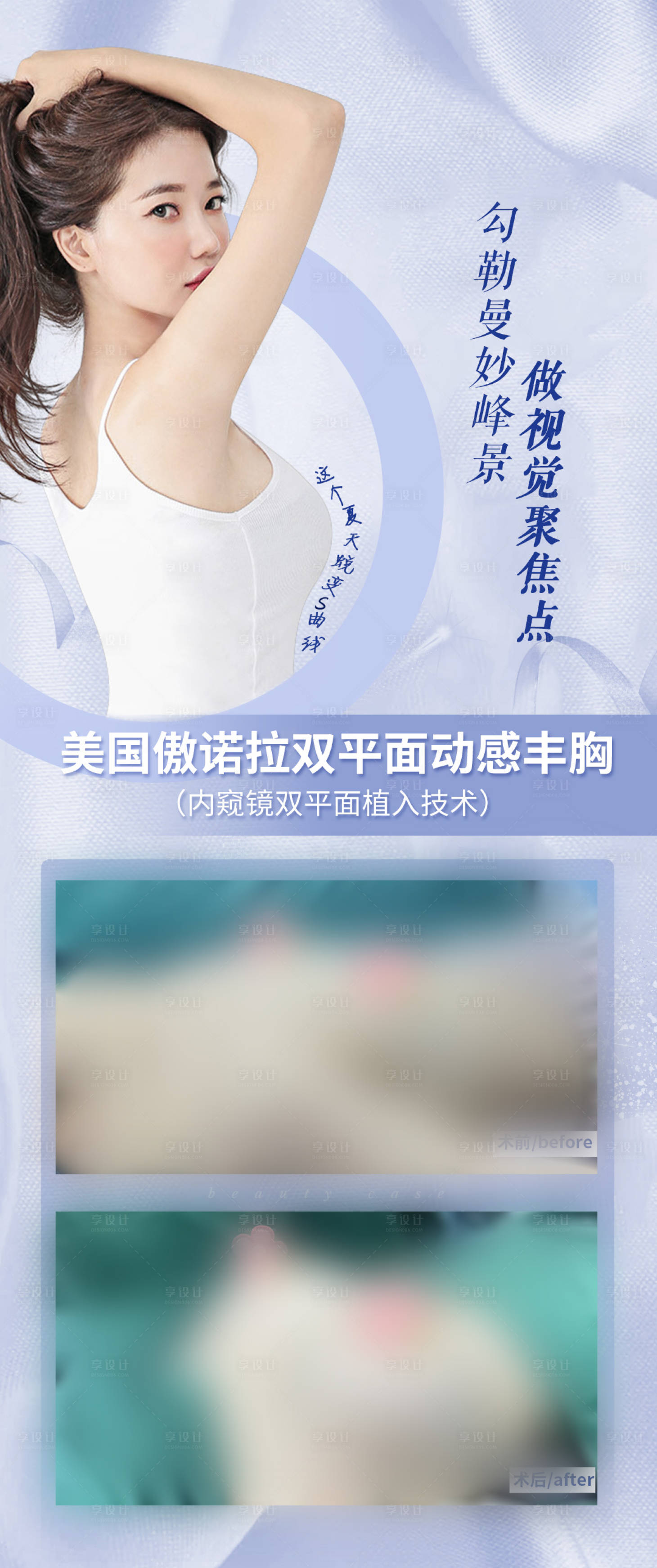 源文件下载【享设计】搜索编号：27850018321751838【医美丰胸案例】