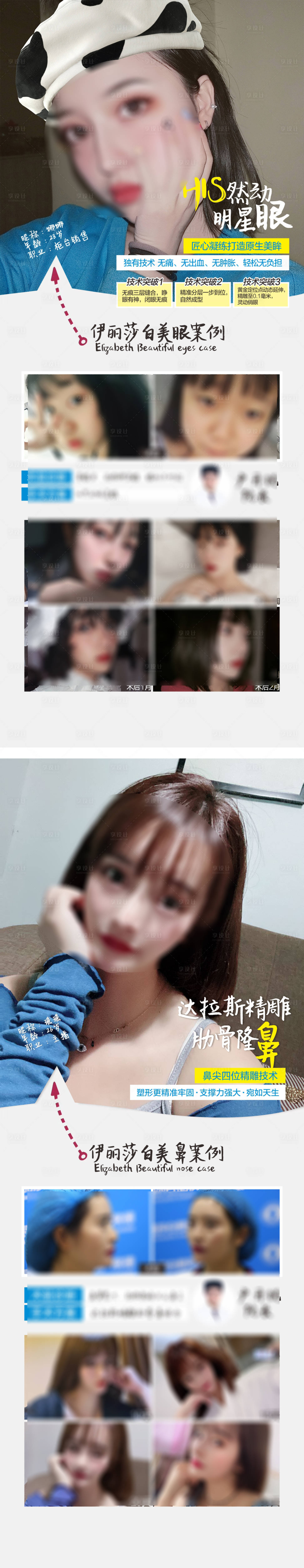源文件下载【享设计】搜索编号：68600018698963695【医美双眼皮鼻子案例长图】
