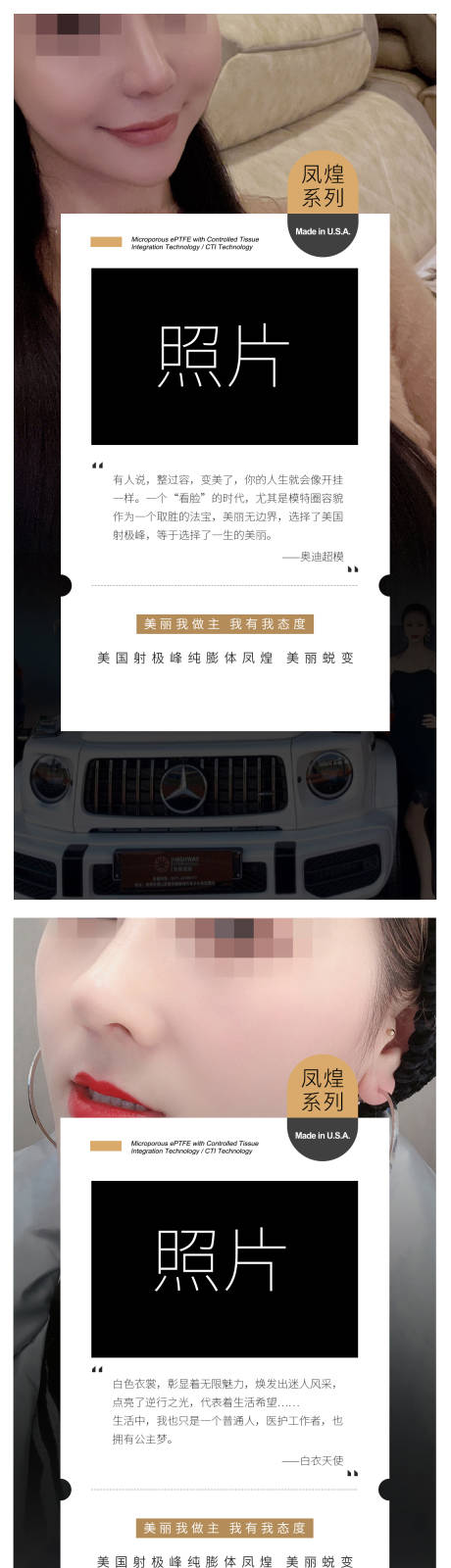 源文件下载【医美案例宣传系列海报】编号：11680019018802164