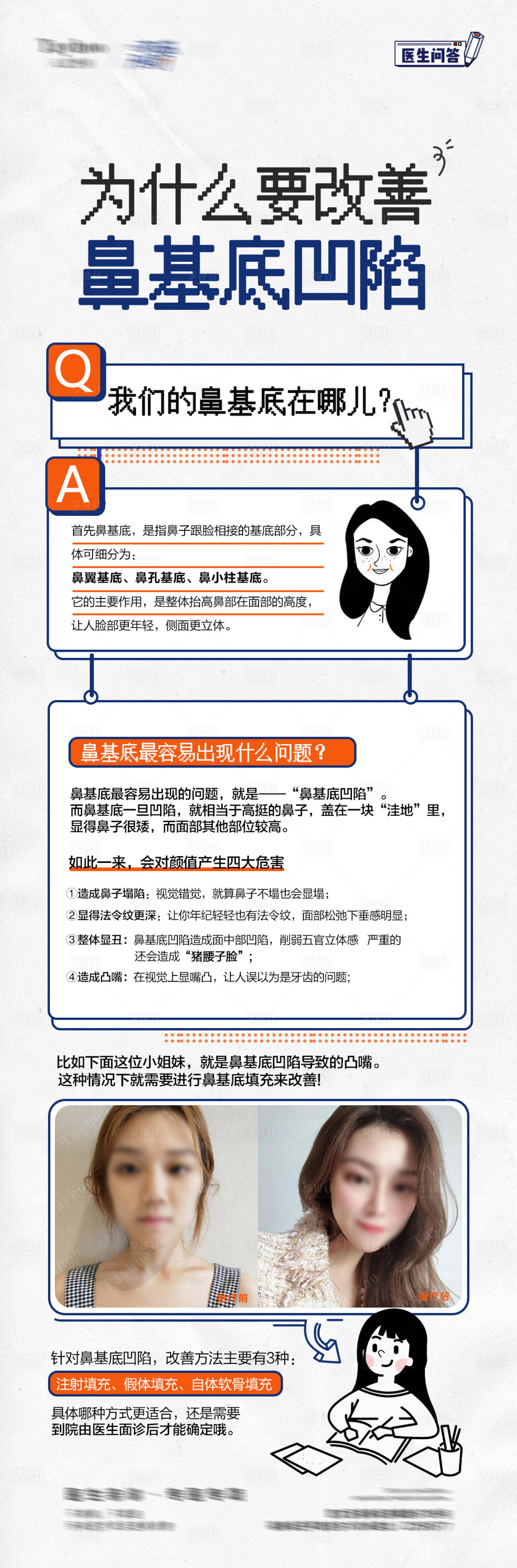 源文件下载【医美鼻基底凹陷海报】编号：64580018441851431