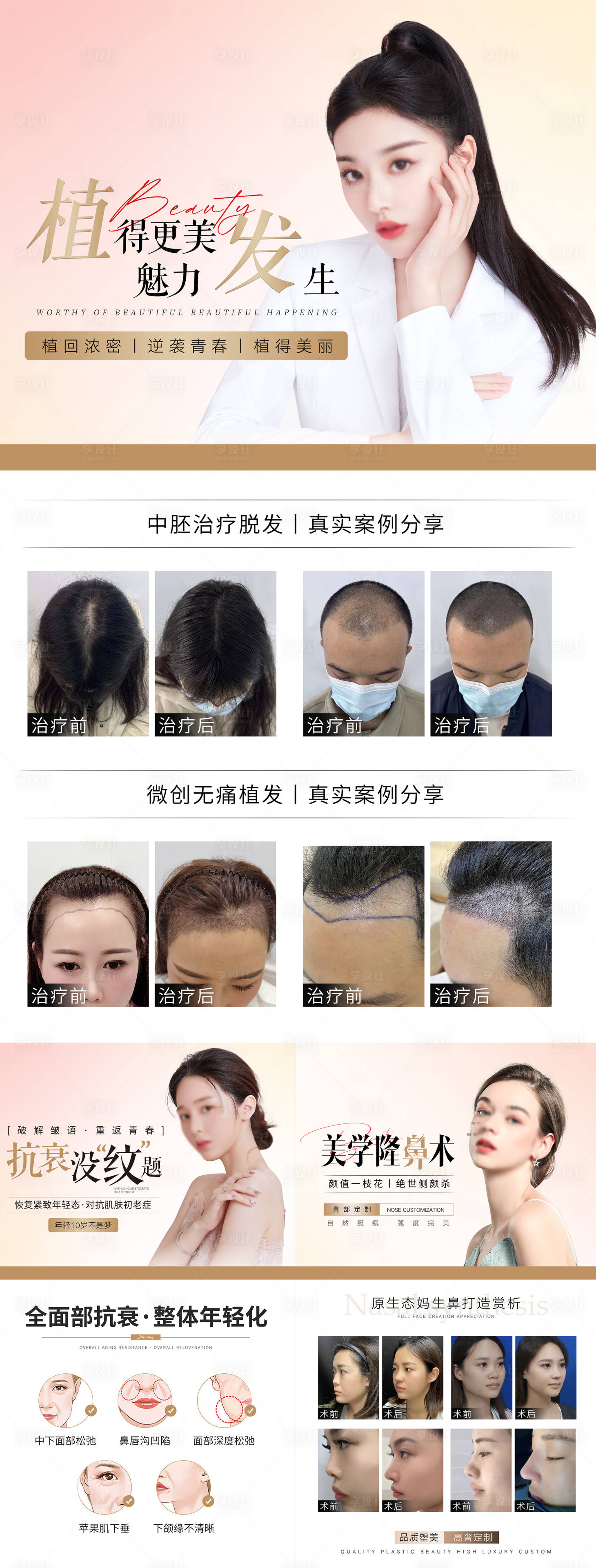 源文件下載【享設計】搜索編號：77670018786862976【醫美植發宣傳海報】