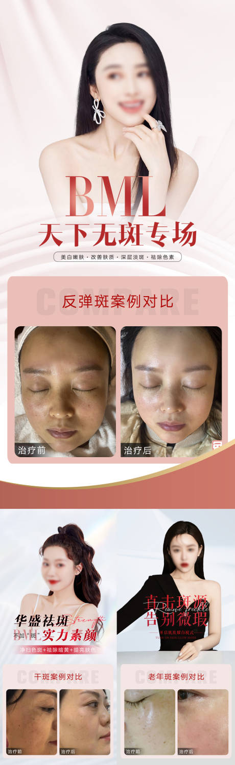 源文件下載【醫(yī)美祛斑皮膚管理系列海報(bào)】編號(hào)：65370018903641243