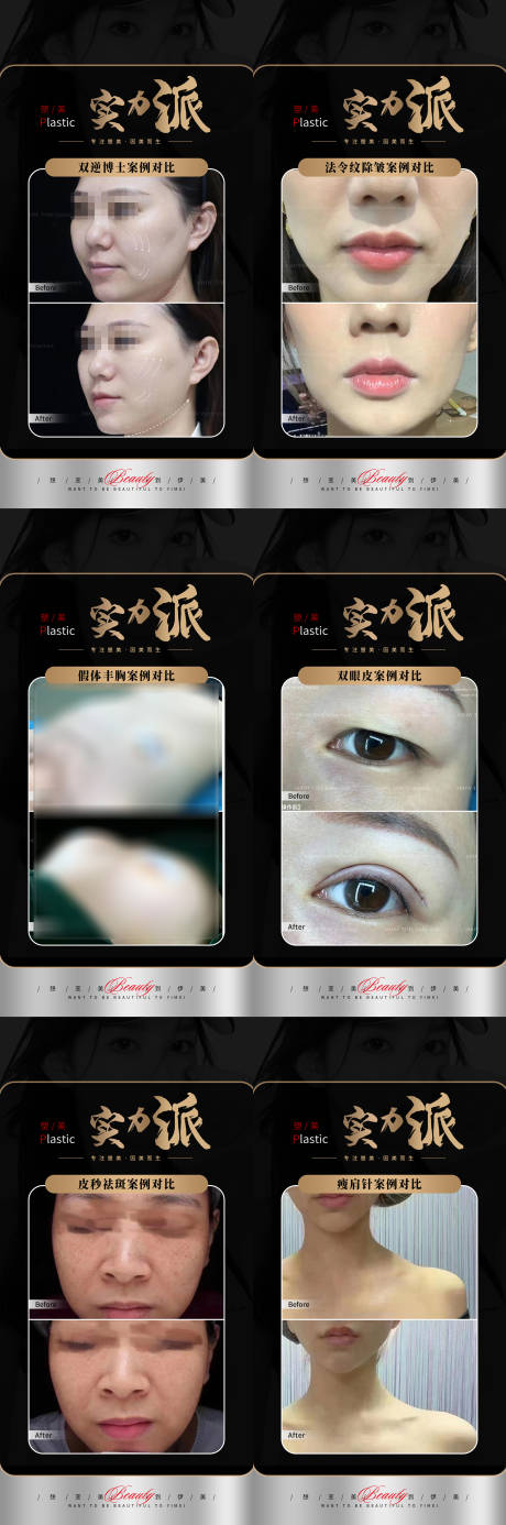 源文件下载【医美黑金案例】编号：98690019041377698