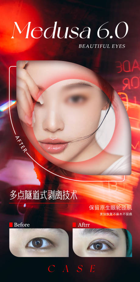 源文件下载【双眼皮案例】编号：65900018433801801