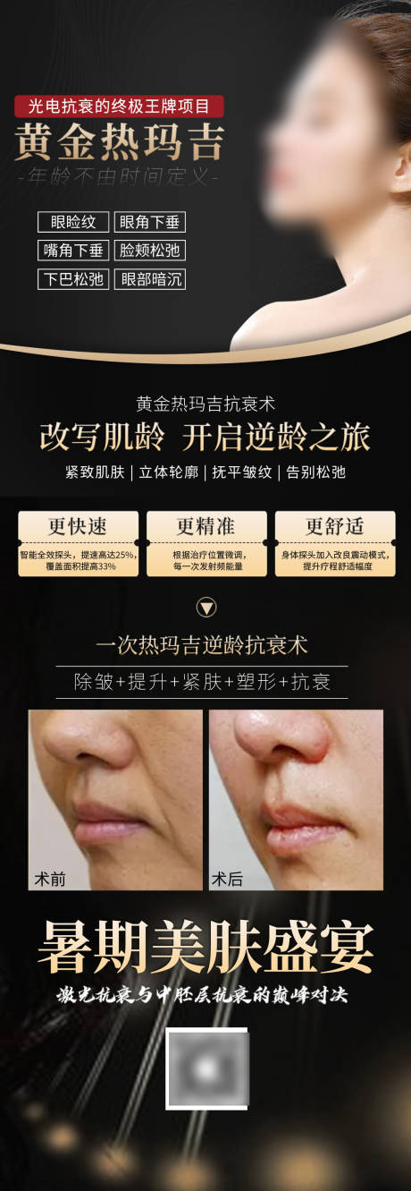 源文件下载【医美热玛吉海报】编号：87130018687887921