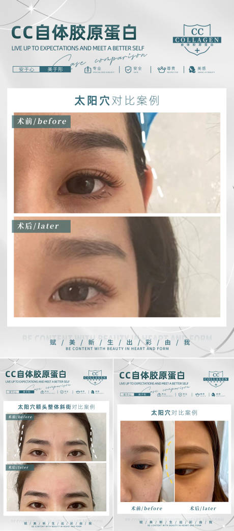 源文件下载【医美对比案例】编号：35000018474392658
