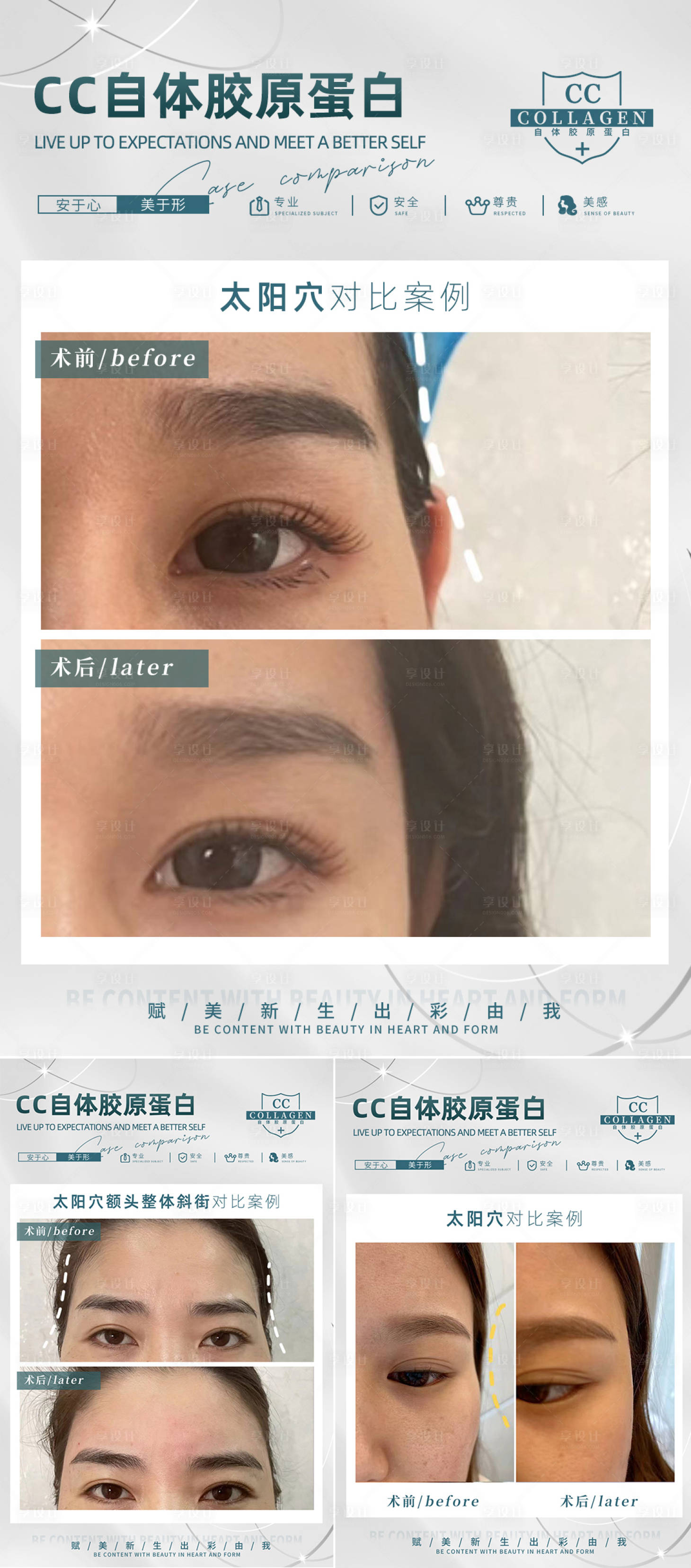 源文件下载【享设计】搜索编号：35000018474392658【医美对比案例】