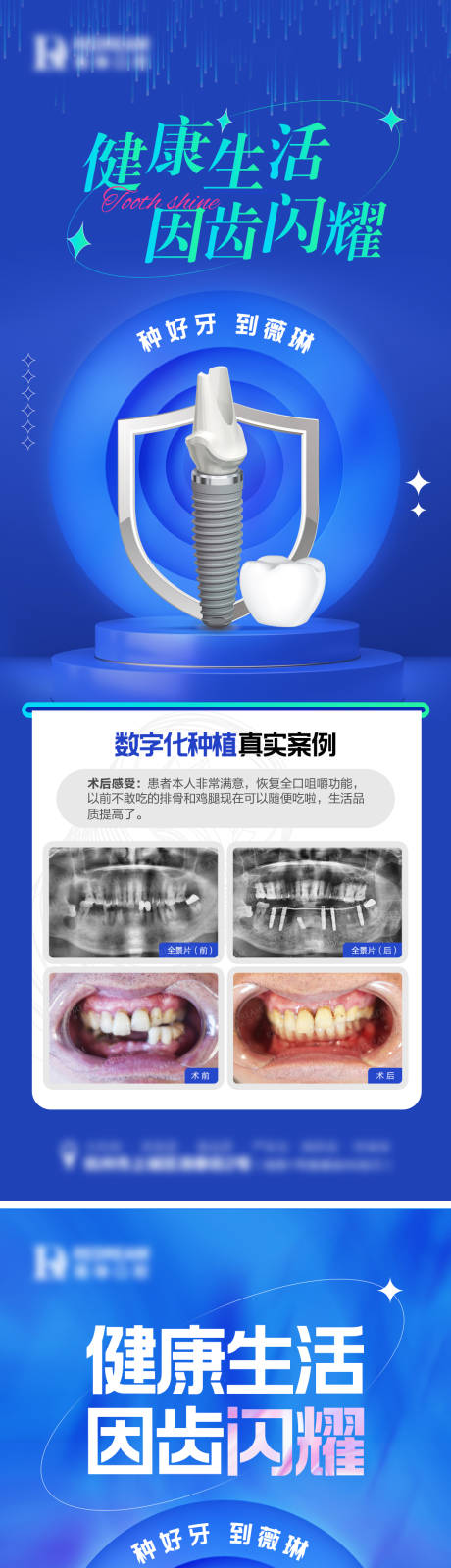 编号：20230816163652647【享设计】源文件下载-口腔种植牙海报