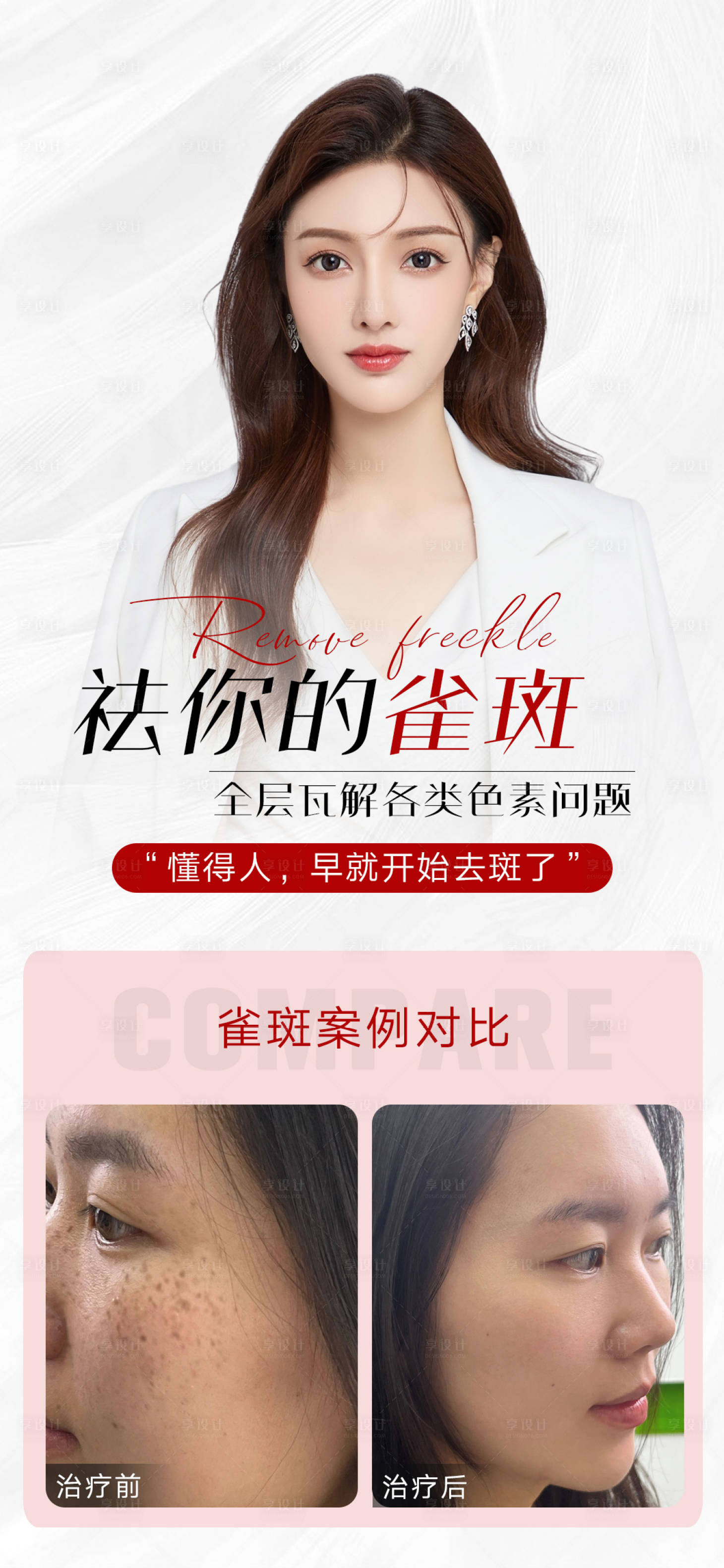 源文件下载【享设计】搜索编号：65780018678019677【医美祛斑海报】