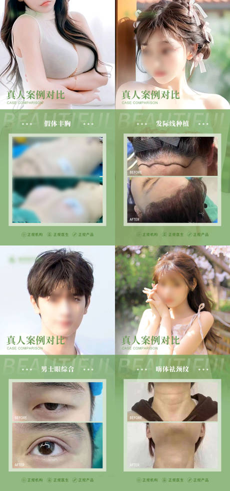 源文件下载【医美整形植发案例合集】编号：57870018949918829