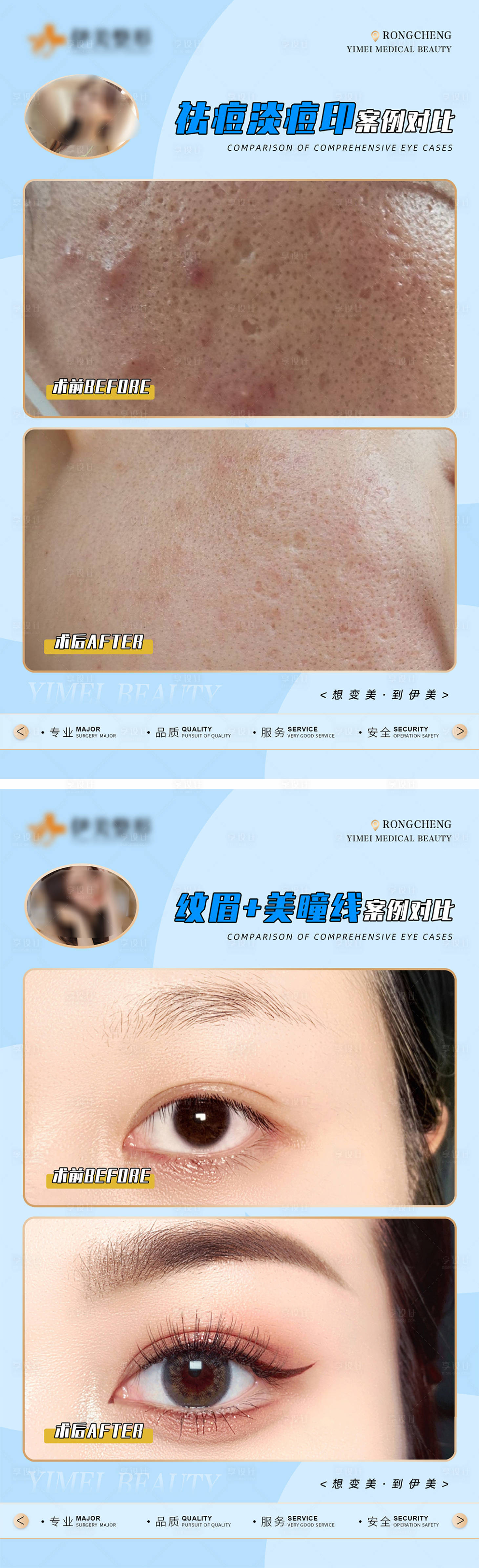 源文件下载【享设计】搜索编号：53500018540148903【医美案例对比模版】