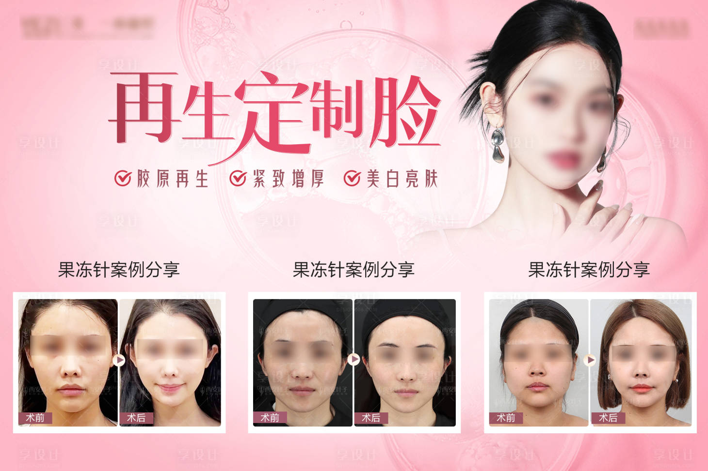 源文件下載【享設計】搜索編號：67440018551743111【醫美整形再生定制臉海報展板】