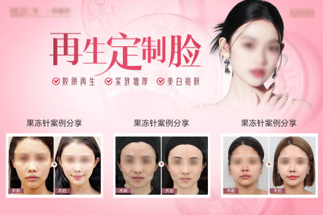 编号：20230806143842848【享设计】源文件下载-医美整形再生定制脸海报展板