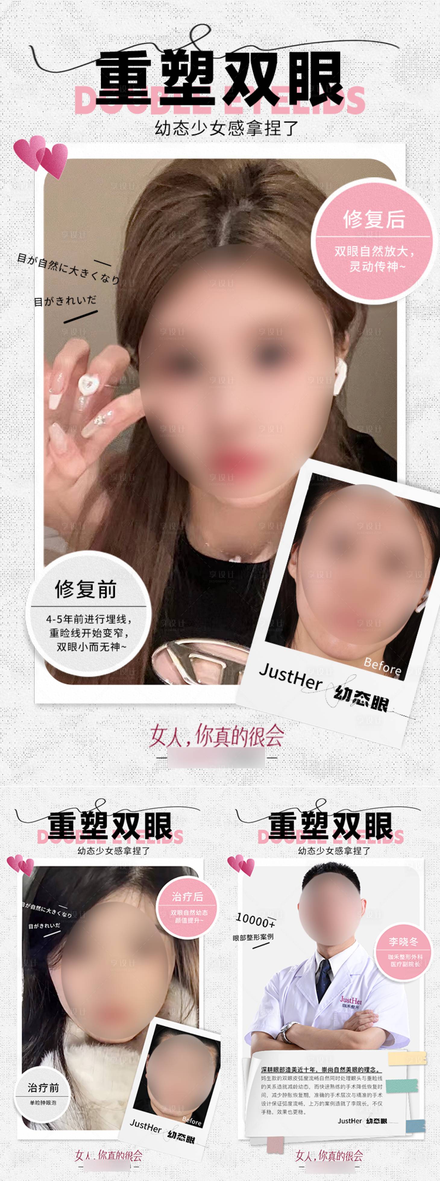 源文件下载【双眼皮案例对比系列海报】编号：67690018970552946