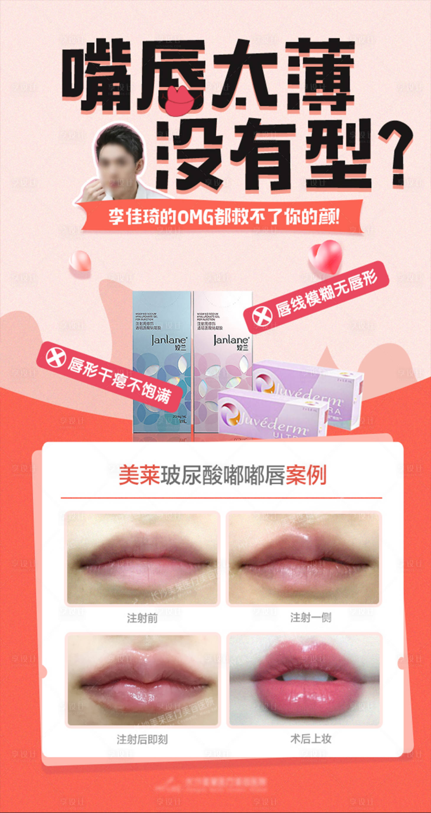 源文件下載【享設計】搜索編號：82570018509189789【醫美醫院玻尿酸宣傳海報】