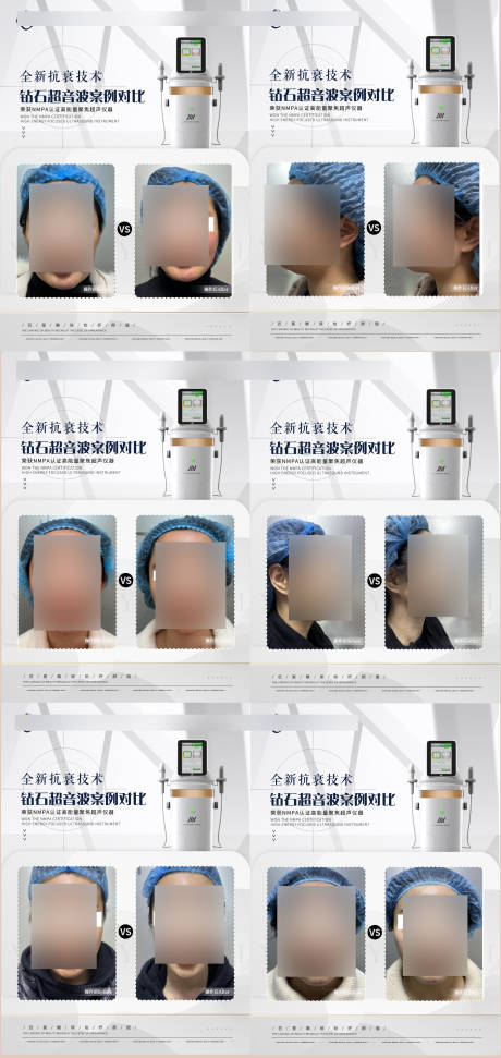 源文件下载【钻石超音波仪器案例对比海报】编号：97950018846223432