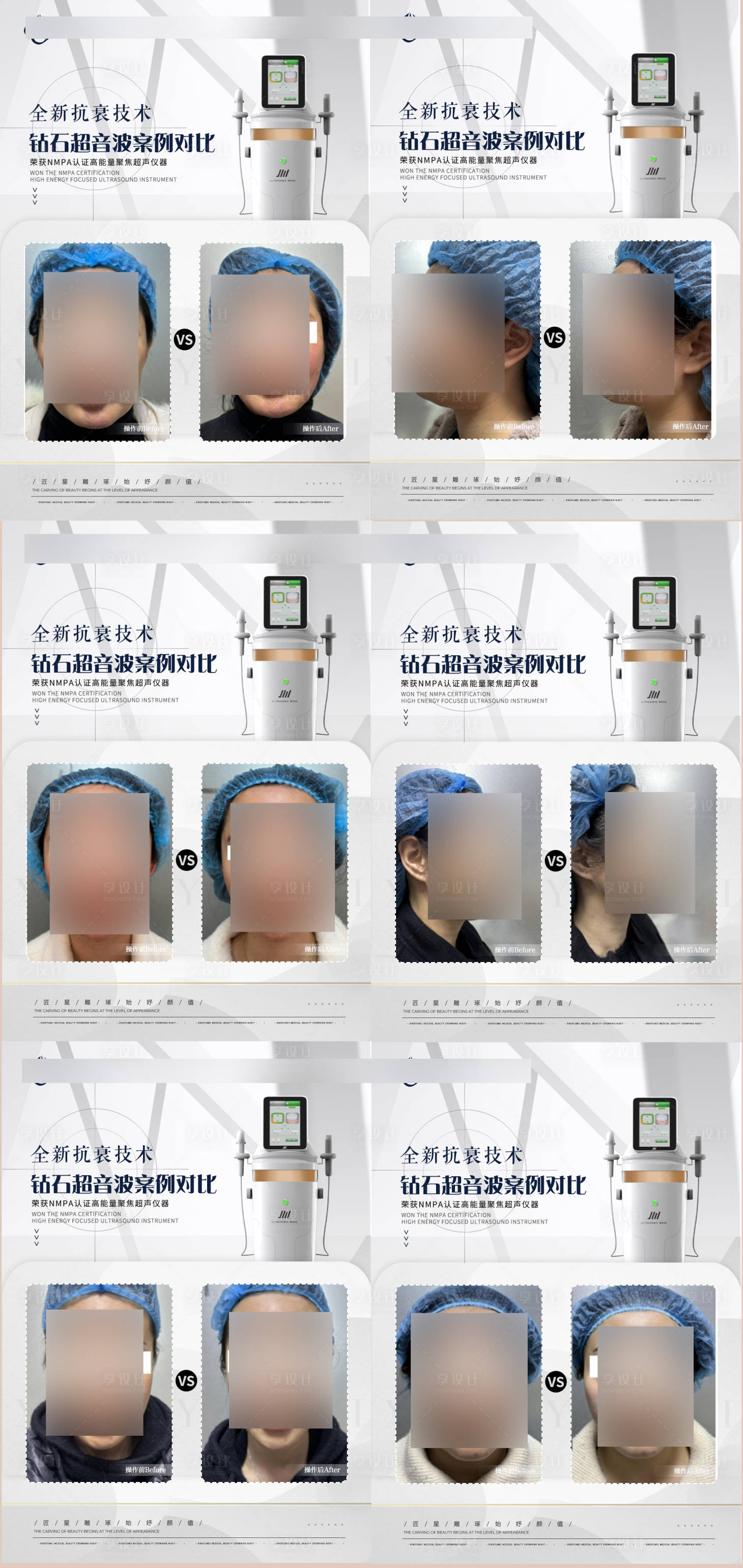 源文件下载【钻石超音波仪器案例对比海报】编号：97950018846223432