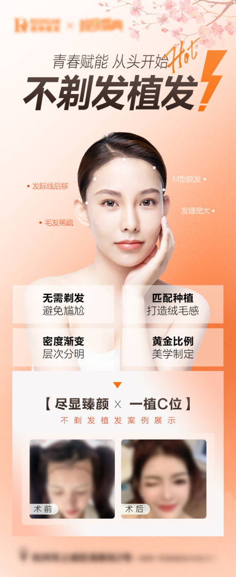 源文件下载【植发】编号：30300018772776365