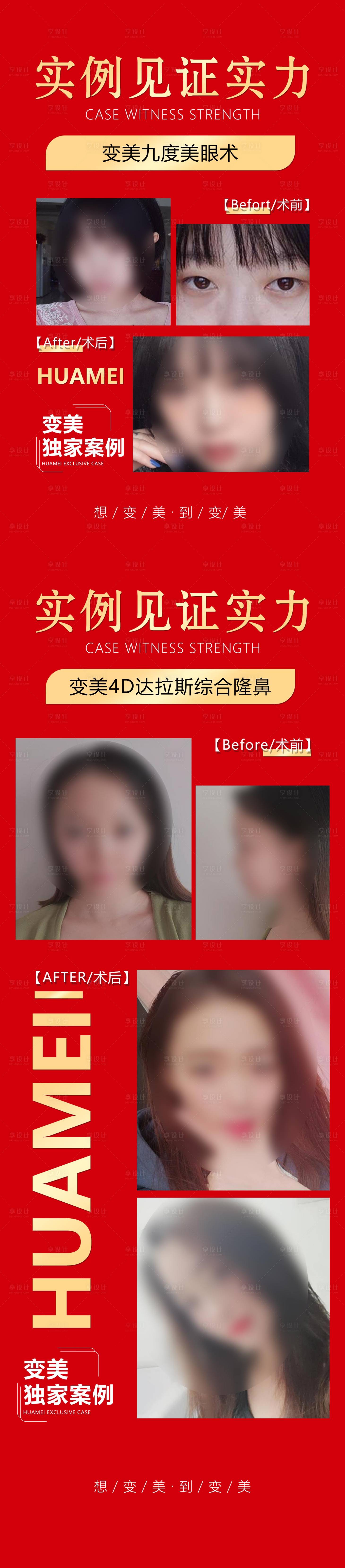 源文件下载【享设计】搜索编号：34870018849587732【用实力见证案例对比长图 】