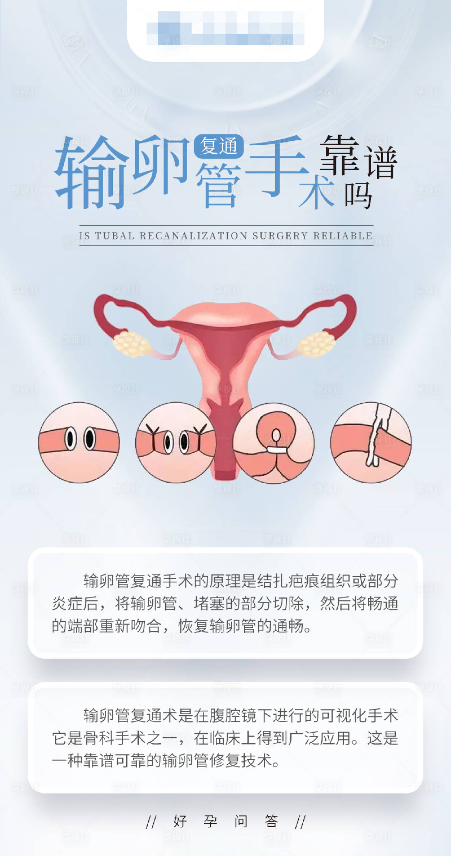 源文件下載【享設計】搜索編號：77410018776422117【備孕科普海報】