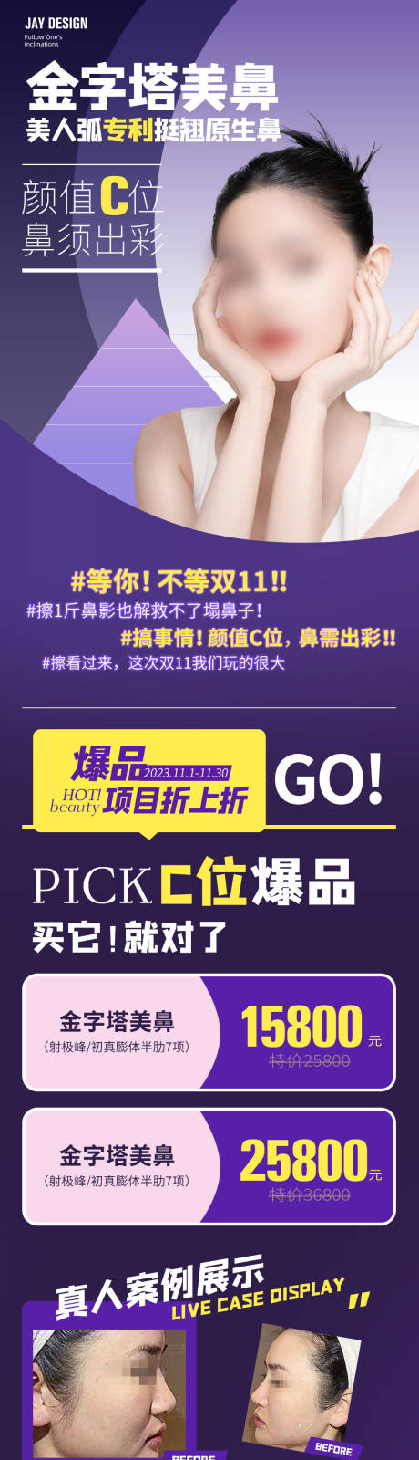 源文件下載【享設計】搜索編號：49390018443137100【醫美隆鼻活動海報】