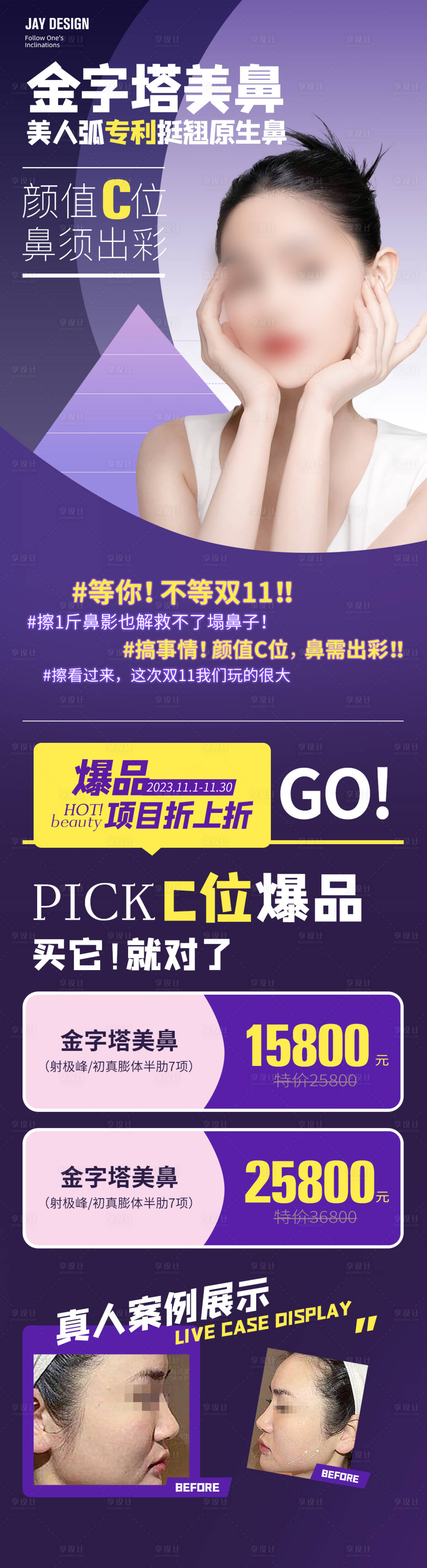 源文件下载【医美隆鼻活动海报】编号：49390018443137100