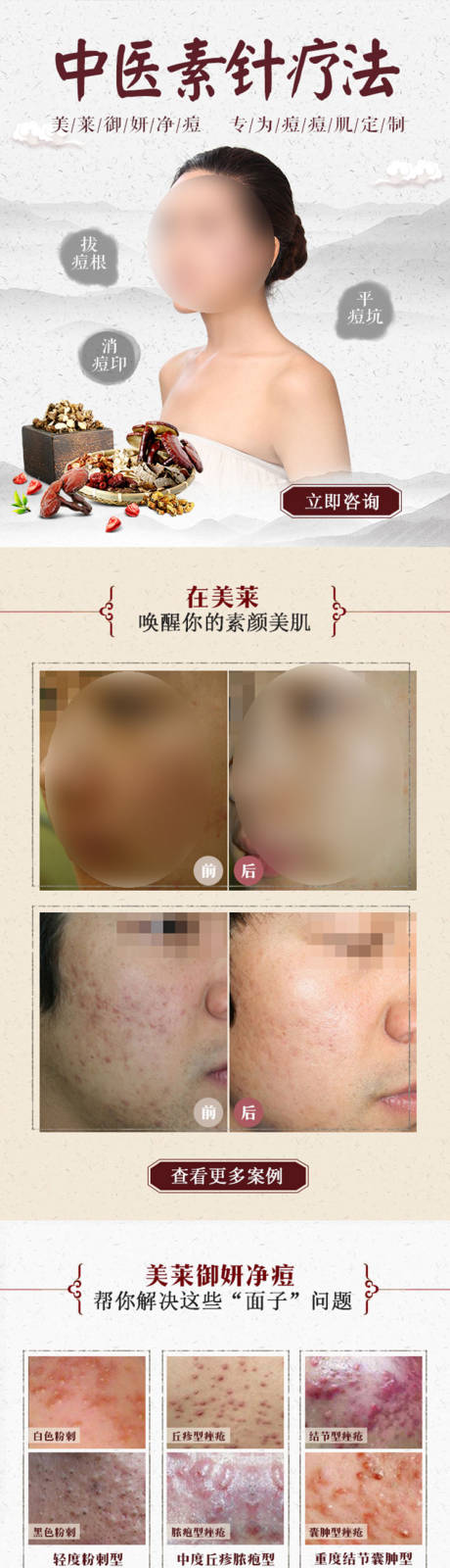 源文件下载【享设计】搜索编号：27130019053932398【医美中医祛痘电商详情页】