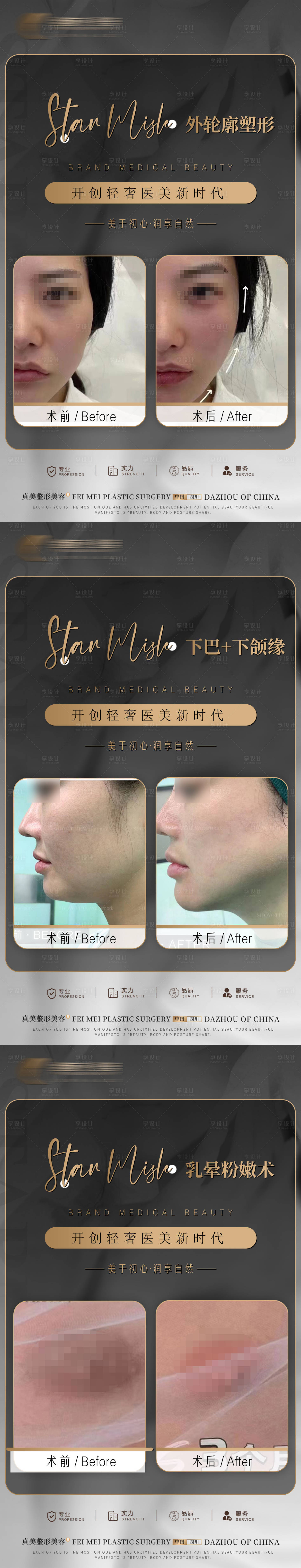 源文件下載【享設(shè)計(jì)】搜索編號(hào)：71510018480741003【醫(yī)美整形案例合集系列海報(bào)】