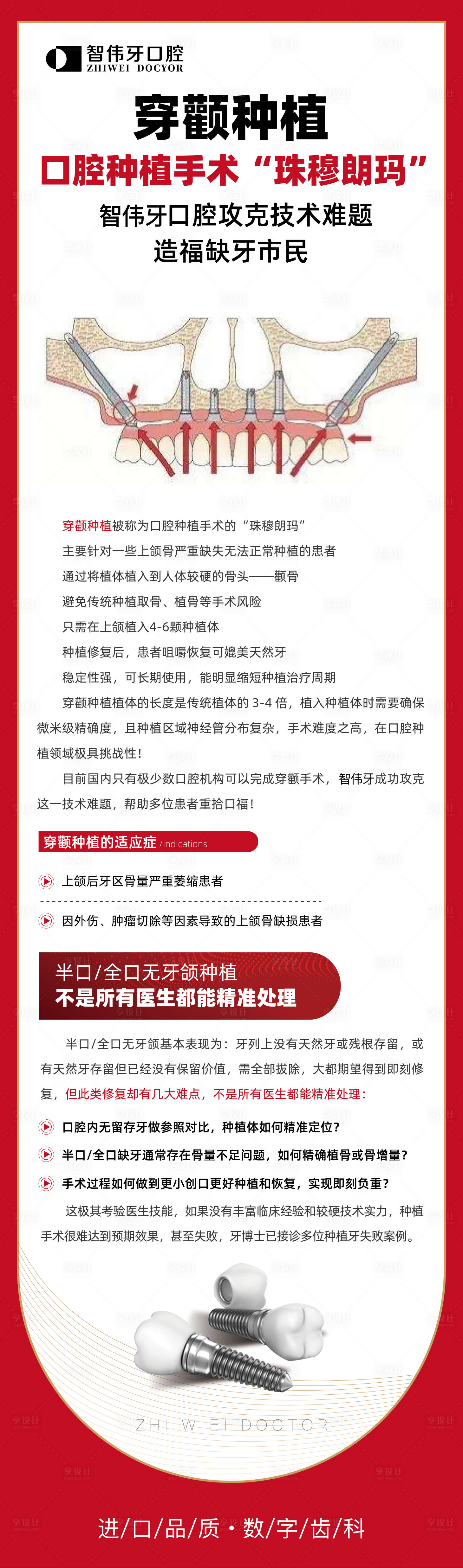 源文件下载【享设计】搜索编号：26870018759931146【口腔种植手术   】